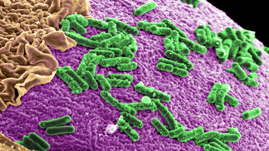 Good Guts – A Promising Treatment for Autism